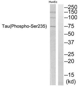 Tau (Phospho-Ser235) Antibody