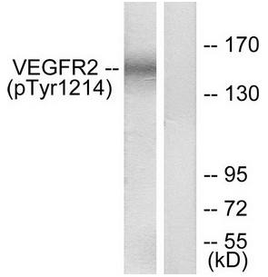 VEGFR2 (Phospho-Tyr1214) Antibody