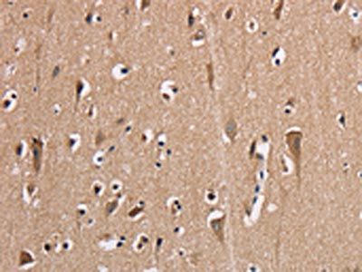AAAS Antibody