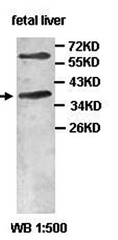 AADAC Rabbit Polyclonal Antibody