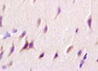 AATK Rabbit Polyclonal Antibody