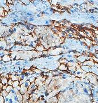 AATK Rabbit Polyclonal Antibody