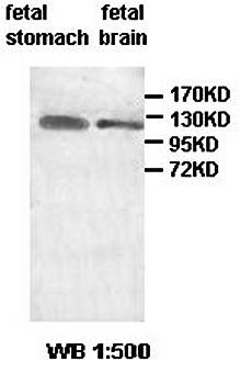 AATK Rabbit Polyclonal Antibody