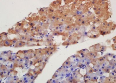 AAV5 capsid protein VP1 Rabbit Polyclonal Antibody