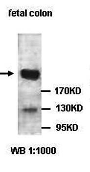 ABCA1 Rabbit Polyclonal Antibody