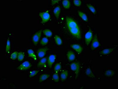 ABCB4 Antibody
