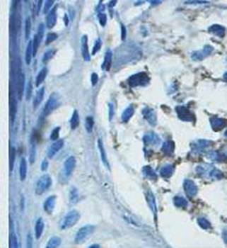 ABCB5 Rabbit Polyclonal Antibody