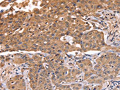 ABCB6 Antibody