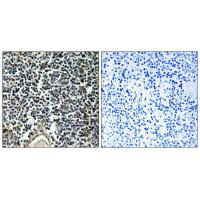 ABCB7 Antibody