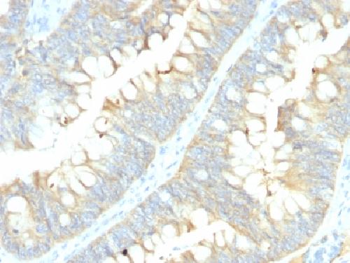 ABCC1 Antibody