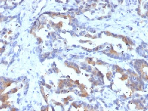 ABCC1 Antibody