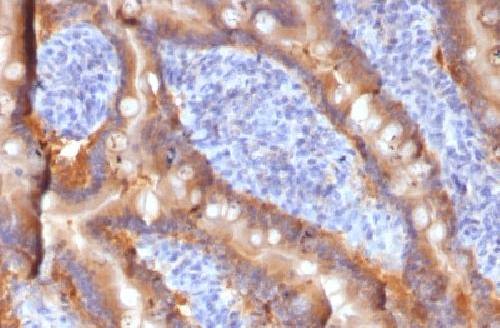 ABCC1 Antibody