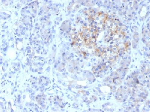 ABCC1 Antibody
