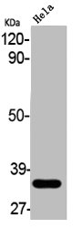 ABCC13 Antibody