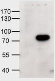 Goat anti-ABCD1 Antibody
