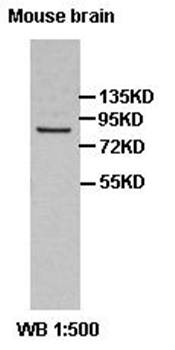 ABCD1 Rabbit Polyclonal Antibody