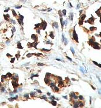 ABCD1 Rabbit Polyclonal Antibody