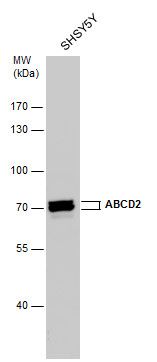 amylase alpha 2A (pancreatic) Antibody