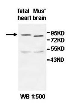 ABCD2 Rabbit Polyclonal Antibody