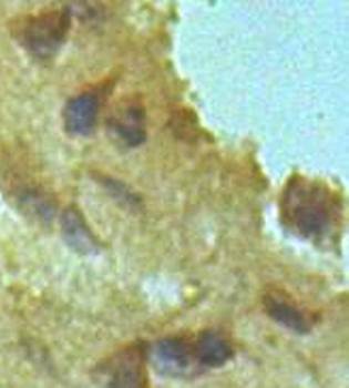 ABCD2 Rabbit Polyclonal Antibody