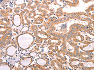 ABCF2 Antibody