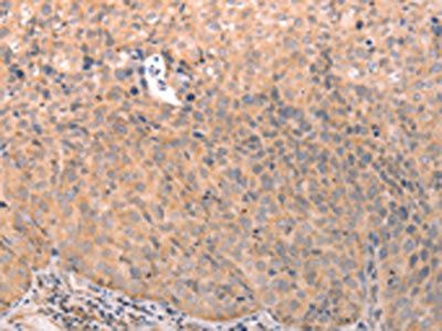 ABCF2 Antibody