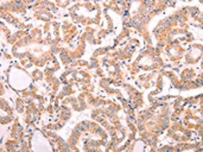 ABCF2 Antibody