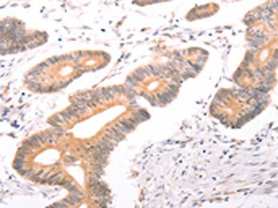 ABCF2 Antibody