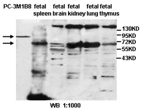 ABCG1 Rabbit Polyclonal Antibody