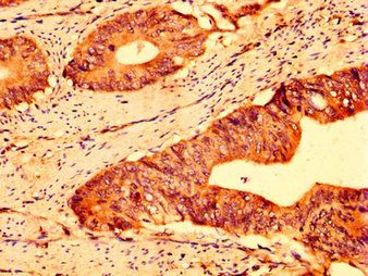 ABCG5 Antibody