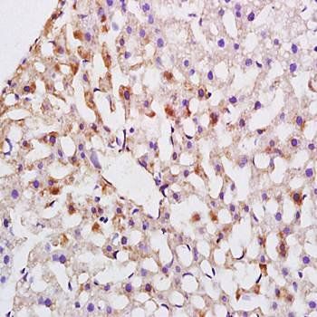 ABCG5 Rabbit Polyclonal Antibody