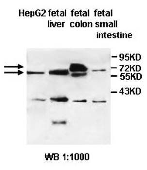 ABCG5 Rabbit Polyclonal Antibody