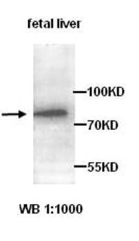 ABCG8 Rabbit Polyclonal Antibody