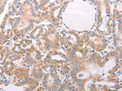 ABHD12 Antibody