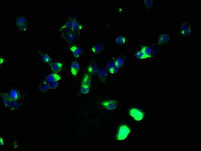 ABHD2 Antibody