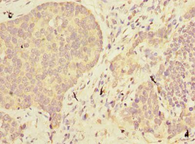 ABHD2 Antibody