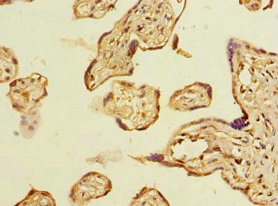 ABHD2 Antibody