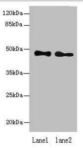 ABHD2 Antibody