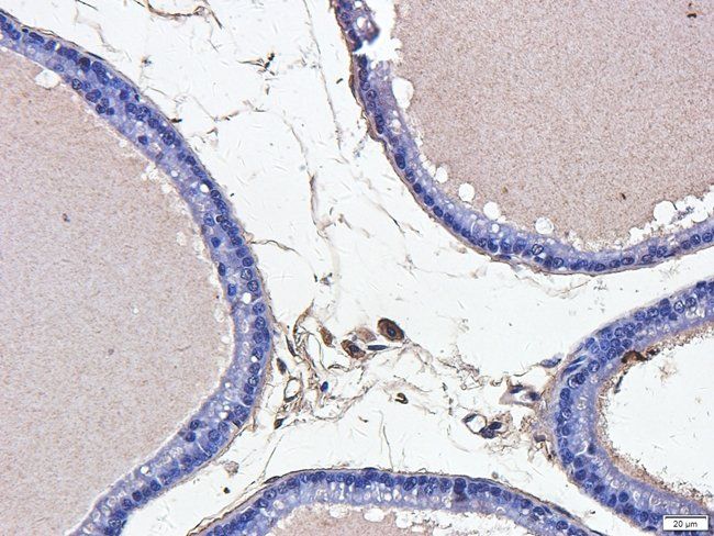 ABL2 Rabbit Polyclonal Antibody