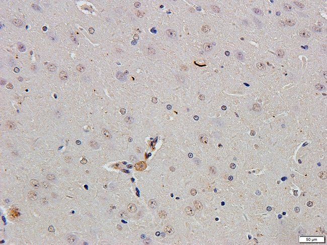 ABL2 Rabbit Polyclonal Antibody