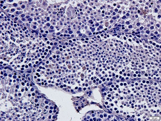 ABL2 Rabbit Polyclonal Antibody