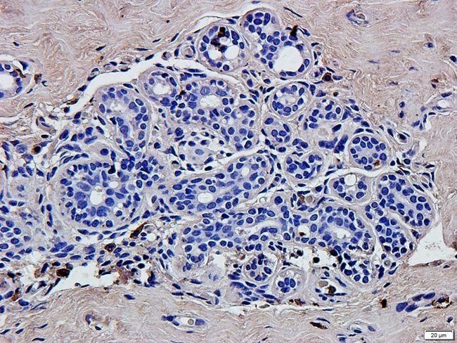 ABL2 Rabbit Polyclonal Antibody