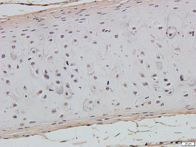 ABL2 Rabbit Polyclonal Antibody