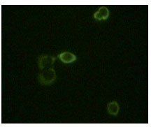 ABL2 Antibody