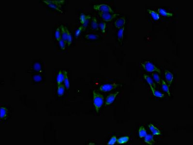 ABLIM1 Antibody