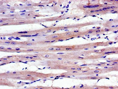 ABLIM1 Antibody