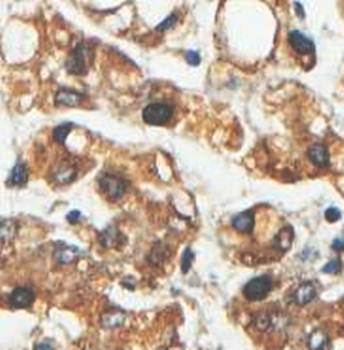 ABLIM1 Rabbit Polyclonal Antibody