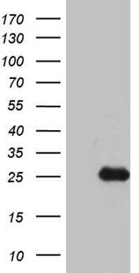 ACAA1 Antibody