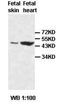ACADM Rabbit Polyclonal Antibody