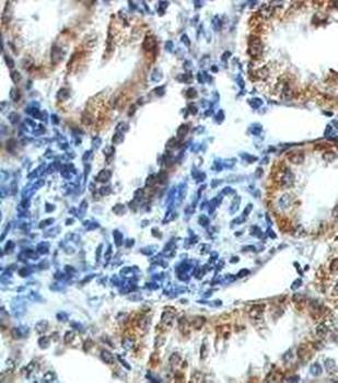 ACADM Rabbit Polyclonal Antibody